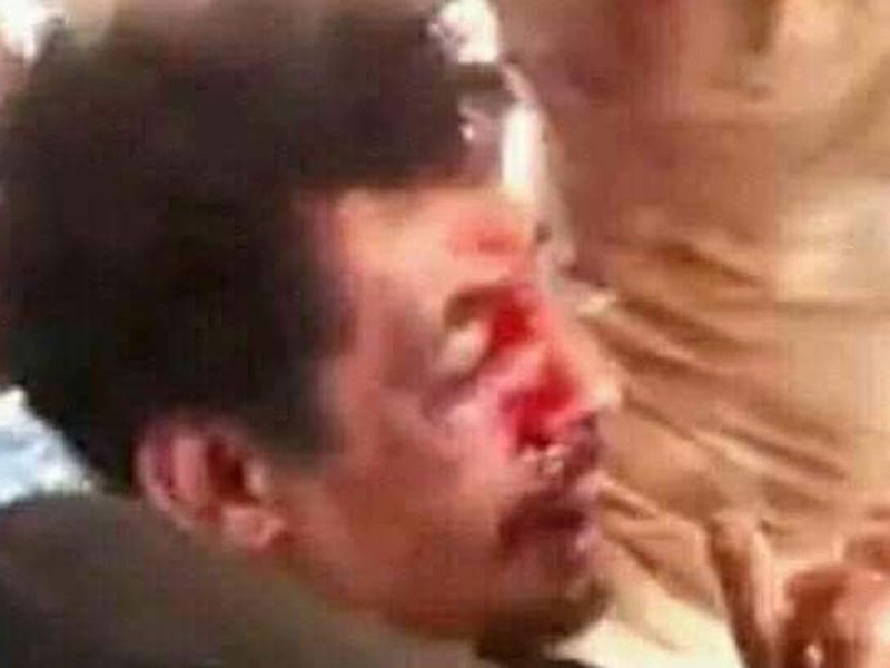 ضجة في الجزائر بعد قتل شاب بريء بتهمة إشعال الحرائق والتنكيل بجثته
